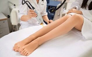 Autoriser et interdire les varices
