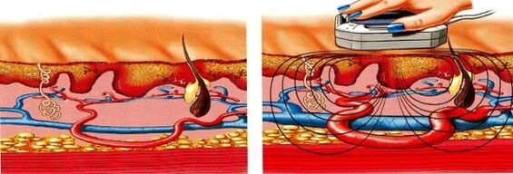 si tes jambes sont engourdies