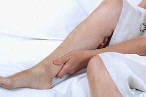Causes et symptômes des varices dans les jambes