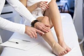 Règles et méthodes de traitement des varices des jambes